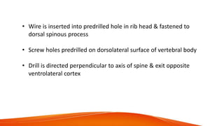 • Wire is inserted into predrilled hole in rib head & fastened to
dorsal spinous process
• Screw holes predrilled on dorsolateral surface of vertebral body
• Drill is directed perpendicular to axis of spine & exit opposite
ventrolateral cortex
 