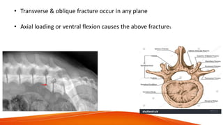 • Transverse & oblique fracture occur in any plane
• Axial loading or ventral flexion causes the above fractures
 
