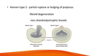 • Hansen type 2 - partial rupture or bulging of pulposus
fibroid degeneration
non chondrodystrophic breeds
 