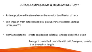 DORSAL LAMINECTOMY & HEMILAMINECTOMY
• Patient positioned in sternal recumbency with dorsiflexion of neck
• Skin incision from external occipital protuberance to dorsal spinous
process of T1
• Hemilaminectomy - create an opening in lateral laminae above the lesion
Enlarge it cranially & caudally with drill / rongeur , usually
1 to 2 vertebral length
 