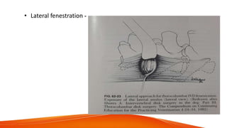 • Lateral fenestration -
 