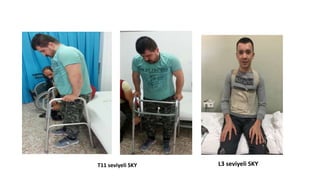 T11 seviyeli SKY L3 seviyeli SKY
 