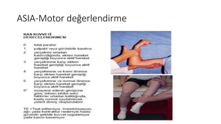 ASIA-Motor değerlendirme
 