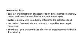 Spinal malformations | PPTX