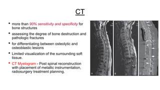 CT
• more than 90% sensitivity and specificity for
bone structures
• assessing the degree of bone destruction and
pathologic fractures
• for differentiating between osteolytic and
osteoblastic lesions
• Limited visualization of the surrounding soft
tissue.
• CT Myelogram - Post spinal reconstruction
with placement of metallic instrumentation,
radiosurgery treatment planning.
 