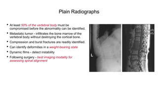 Plain Radiographs
• At least 50% of the vertebral body must be
compromised before the abnormality can be identified.
• Metastatic tumor - infiltrates the bone marrow of the
vertebral body without destroying the cortical bone.
• Compression and burst fractures are readily identified.
• Can identify deformities in a weight-bearing state
• Dynamic films - detect instability
• Following surgery - best imaging modality for
assessing spinal alignment
 