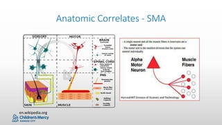 Spinal Muscular Atrophy: Diagnosis and Global Management Considerations ...