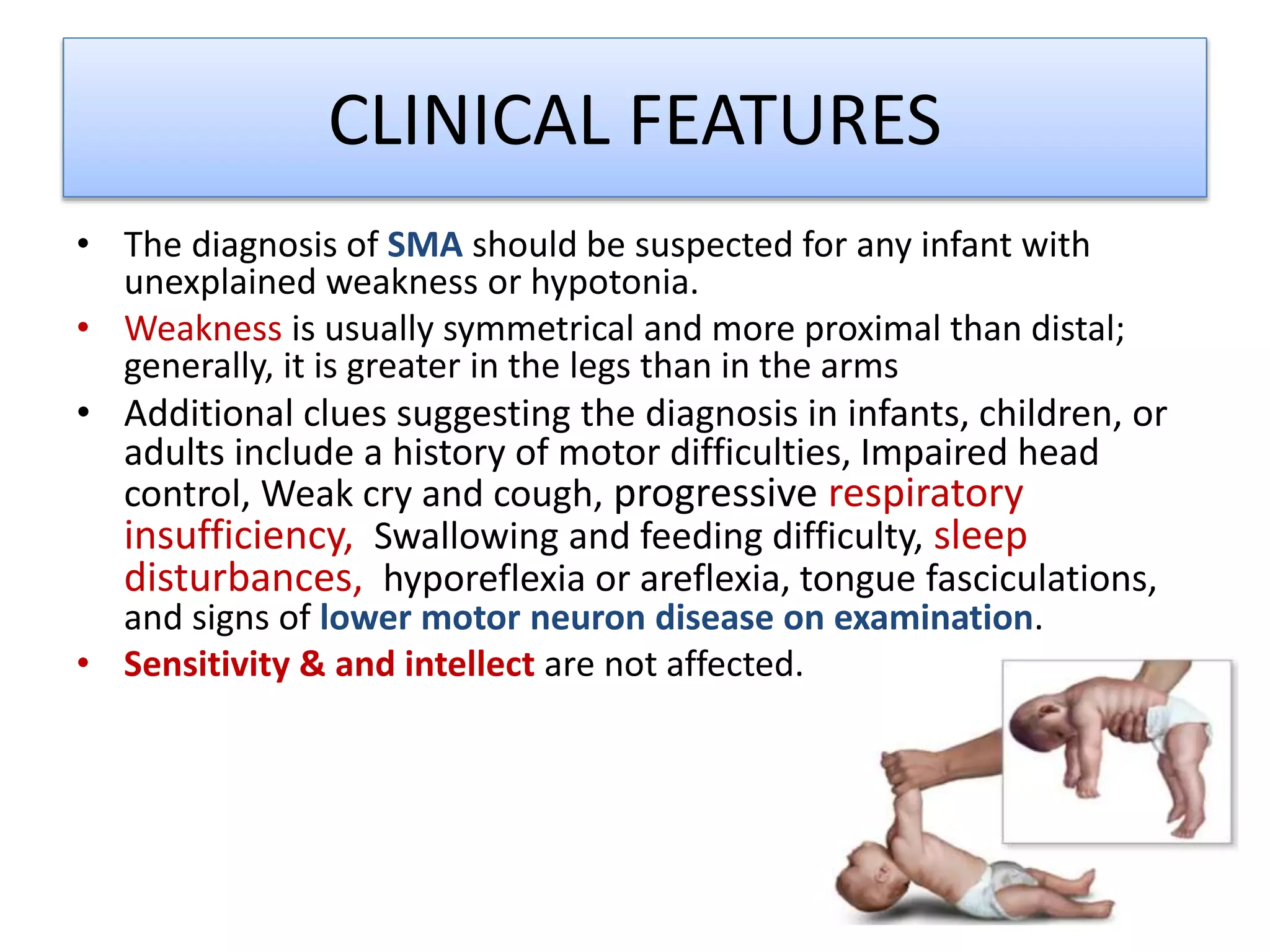 Spinal muscular atrophy (sma) | PPTX