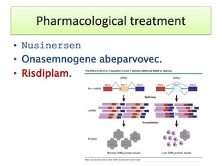 • Nusinersen
• Onasemnogene abeparvovec.
• Risdiplam.
Pharmacological treatment
 