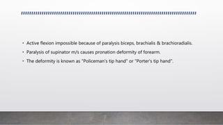 • Active flexion impossible because of paralysis biceps, brachialis & brachioradialis.
• Paralysis of supinator m/s causes pronation deformity of forearm.
• The deformity is known as "Policeman's tip hand" or "Porter's tip hand".
 