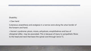 Disability:
• Claw hand
Cutaneous anaesthesia and analgesia in a narrow zone along the ulnar border of
the forearm and hand.
• Horner's syndrome: ptosis, miosis, anhydrosis, enophthalmos and loss of
ciliospinal reflex- may be associated. This is because of injury to sympathetic fibres
to the head and neck that leave the spinal cord through nerve T1.
 