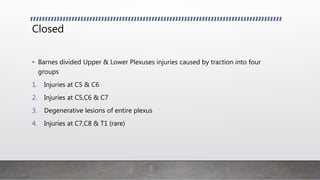 Closed
• Barnes divided Upper & Lower Plexuses injuries caused by traction into four
groups
1. Injuries at C5 & C6
2. Injuries at C5,C6 & C7
3. Degenerative lesions of entire plexus
4. Injuries at C7,C8 & T1 (rare)
 
