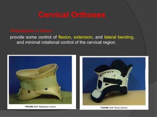 Cervical Orthoses
Philadelphia or Miami
provide some control of flexion, extension, and lateral bending,
and minimal rotational control of the cervical region.

 