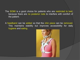 The SOMI is a good choice for patients who are restricted to bed,
because there are no posterior rods to interfere with comfort of
the patient.

A headband can be added so that the chin piece can be removed.
This maintains stability but improves accessibility for daily
hygiene and eating.

 