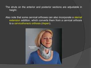 The struts on the anterior and posterior sections are adjustable in
height.
Also note that some cervical orthoses can also incorporate a sternal
extension addition, which converts them from a cervical orthosis
to a cervicothoracic orthosis (Aspen).

 