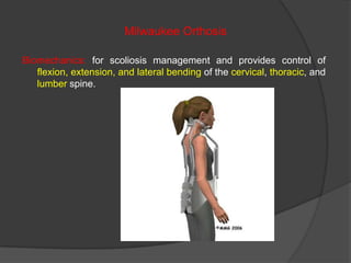 Milwaukee Orthosis
Biomechanics: for scoliosis management and provides control of
flexion, extension, and lateral bending of the cervical, thoracic, and
lumber spine.

 