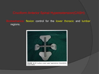Cruciform Anterior Spinal Hyperextension(CASH)
Biomechanics: flexion control for the lower thoracic and lumbar
regions.

 