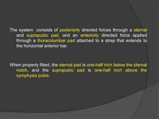 The system consists of posteriorly directed forces through a sternal
and suprapubic pad, and an anteriorly directed force applied
through a thoracolumbar pad attached to a strap that extends to
the horizontal anterior bar.

When properly fitted, the sternal pad is one-half inch below the sternal
notch, and the suprapubic pad is one-half inch above the
symphysis pubis.

 