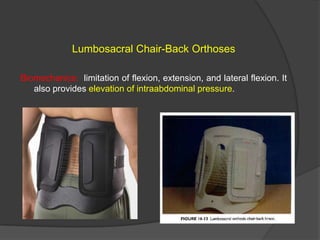 Lumbosacral Chair-Back Orthoses
Biomechanics: limitation of flexion, extension, and lateral flexion. It
also provides elevation of intraabdominal pressure.

 