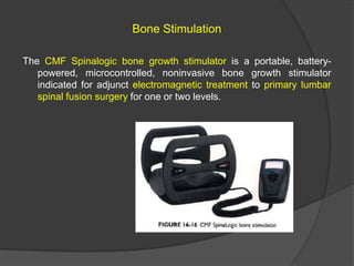 Bone Stimulation
The CMF Spinalogic bone growth stimulator is a portable, batterypowered, microcontrolled, noninvasive bone growth stimulator
indicated for adjunct electromagnetic treatment to primary lumbar
spinal fusion surgery for one or two levels.

 