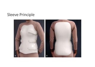Sleeve Principle
 