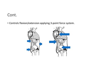 Cont.
• Controls flexion/extension applying 3-point force system.
 
