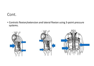 Cont.
• Controls flexion/extension and lateral flexion using 3-point pressure
systems.
 