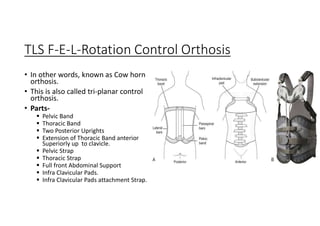 TLS F-E-L-Rotation Control Orthosis
• In other words, known as Cow horn
orthosis.
• This is also called tri-planar control
orthosis.
• Parts-
 Pelvic Band
 Thoracic Band
 Two Posterior Uprights
 Extension of Thoracic Band anterior
Superiorly up to clavicle.
 Pelvic Strap
 Thoracic Strap
 Full front Abdominal Support
 Infra Clavicular Pads.
 Infra Clavicular Pads attachment Strap.
 