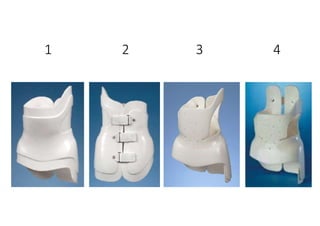 1 2 3 4
 