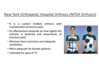 New York Orthopedic Hospital Orthosis (NYOH Orthosis)
• It is a custom molded orthosis with
incorporated corrective pads.
• Its effectiveness depends on how tightly the
orthosis is fastened and placements of
pressure pads.
• Minimal chest restriction and adequate
ventilation.
• More adequate for female patients.
• Indicated for apex of T7.
 