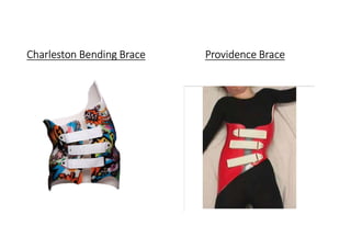 Charleston Bending Brace Providence Brace
 