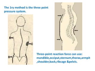 Spinal orthosis | PPTX