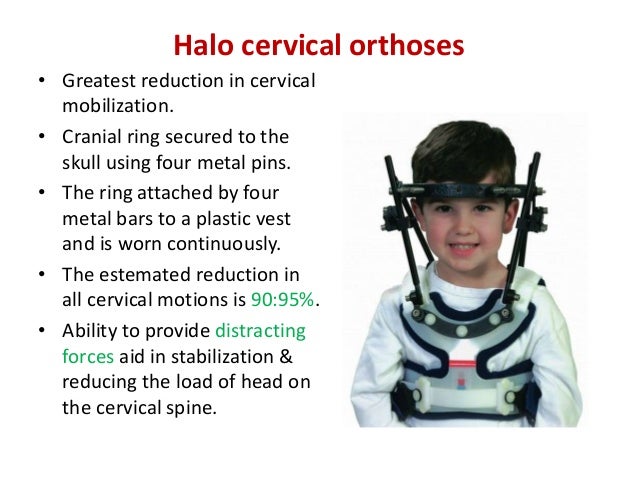 spinal orthosis the application of a cranial halo is a form of