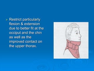  Restrict particularly
flexion & extension
due to better fit at the
occiput and the chin
as well as the
improved contact on
the upper thorax.
 