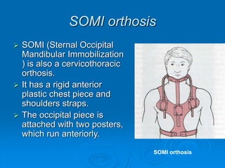 SOMI orthosis
 SOMI (Sternal Occipital
Mandibular Immobilization
) is also a cervicothoracic
orthosis.
 It has a rigid anterior
plastic chest piece and
shoulders straps.
 The occipital piece is
attached with two posters,
which run anteriorly.
SOMI orthosis
 