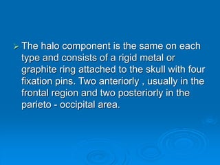  The halo component is the same on each
type and consists of a rigid metal or
graphite ring attached to the skull with four
fixation pins. Two anteriorly , usually in the
frontal region and two posteriorly in the
parieto - occipital area.
 