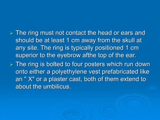  The ring must not contact the head or ears and
should be at least 1 cm away from the skull at
any site. The ring is typically positioned 1 cm
superior to the eyebrow afthe top of the ear.
 The ring is bolted to four posters which run down
onto either a polyethylene vest prefabricated like
an " X" or a plaster cast, both of them extend to
about the umbilicus.
 