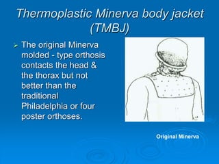 Thermoplastic Minerva body jacket
(TMBJ)
 The original Minerva
molded - type orthosis
contacts the head &
the thorax but not
better than the
traditional
Philadelphia or four
poster orthoses.
Original Minerva
 