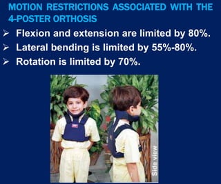 Spinal orthosis dr.aliaa | PPTX