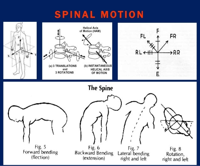 Spinal orthosis dr.aliaa