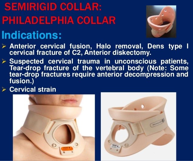 Spinal Orthosis Dr Aliaa
