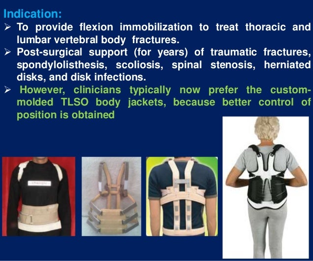spinal orthosis dr aliaa