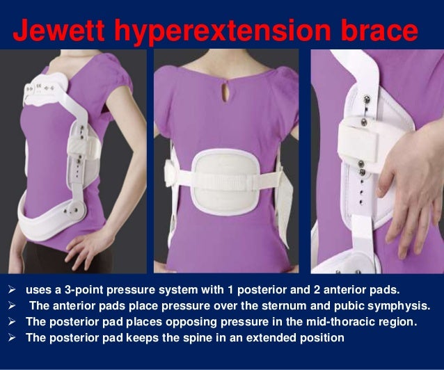 Spinal orthosis dr.aliaa