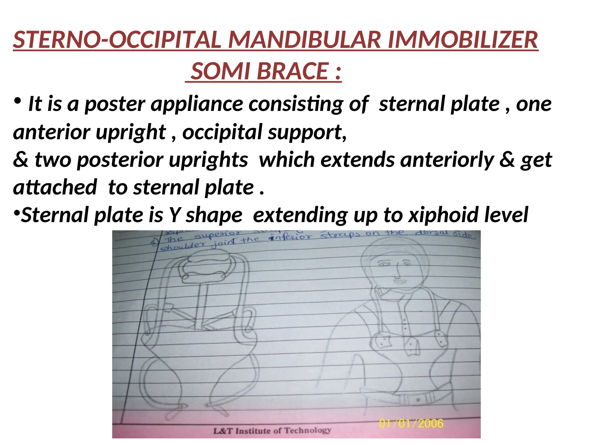 STERNO-OCCIPITAL MANDIBULAR IMMOBILIZER
SOMI BRACE :
• It is a poster appliance consisting of sternal plate , one
anterior upright , occipital support,
& two posterior uprights which extends anteriorly & get
attached to sternal plate .
•Sternal plate is Y shape extending up to xiphoid level
 