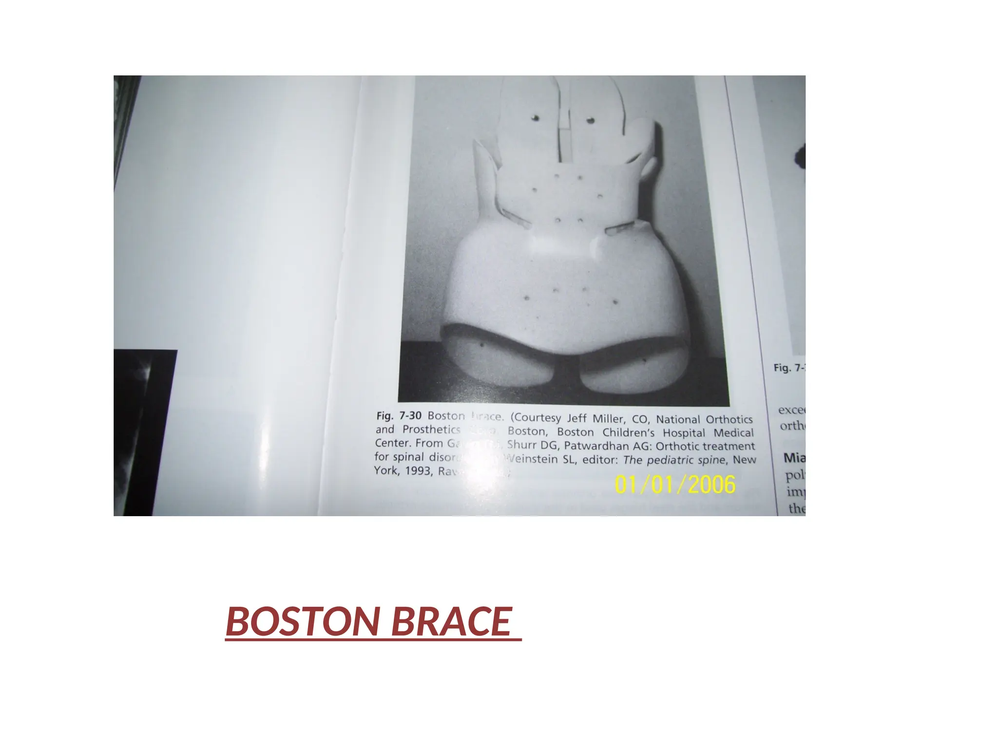 BOSTON BRACE
 