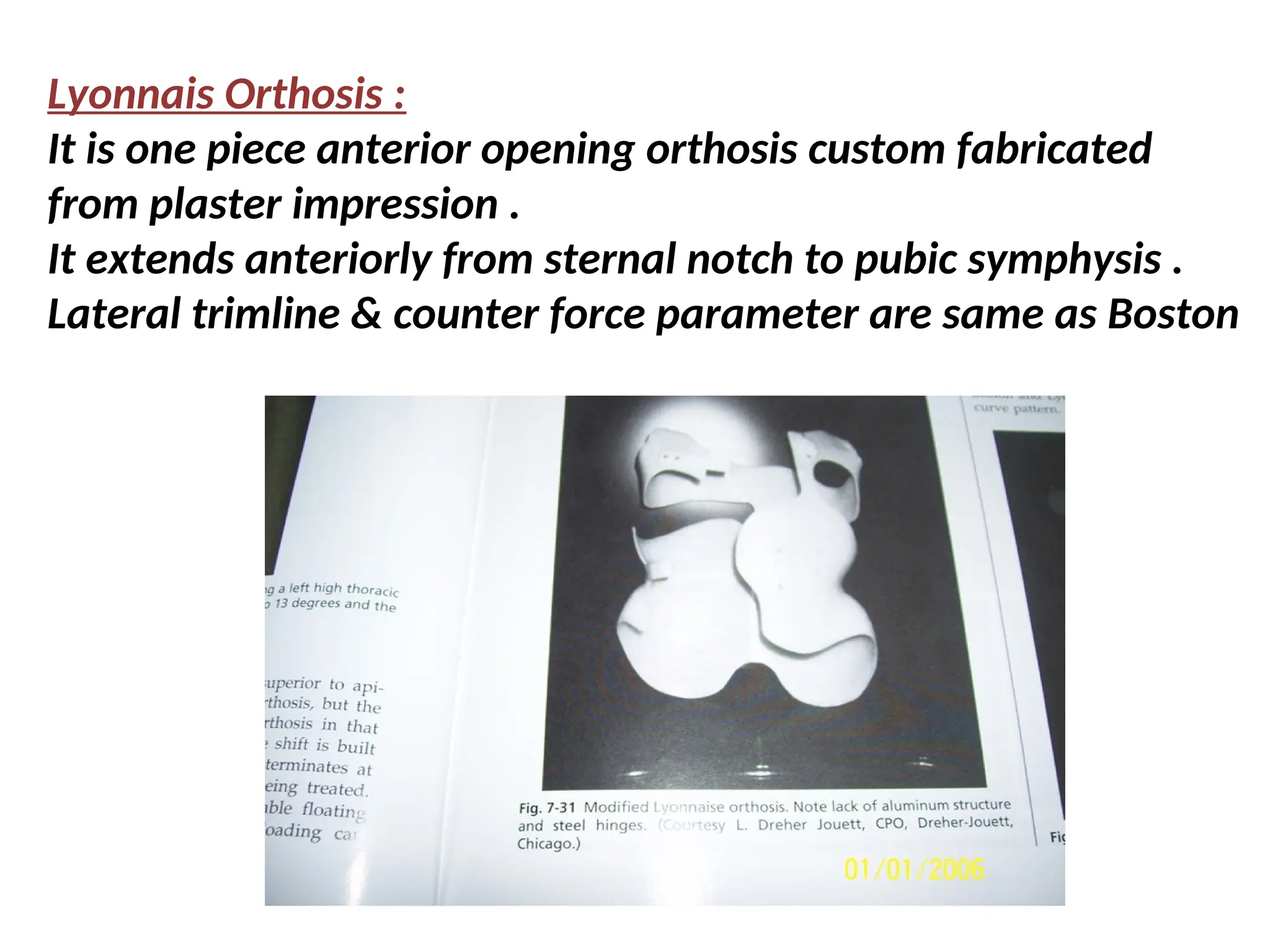 Lyonnais Orthosis :
It is one piece anterior opening orthosis custom fabricated
from plaster impression .
It extends anteriorly from sternal notch to pubic symphysis .
Lateral trimline & counter force parameter are same as Boston
 