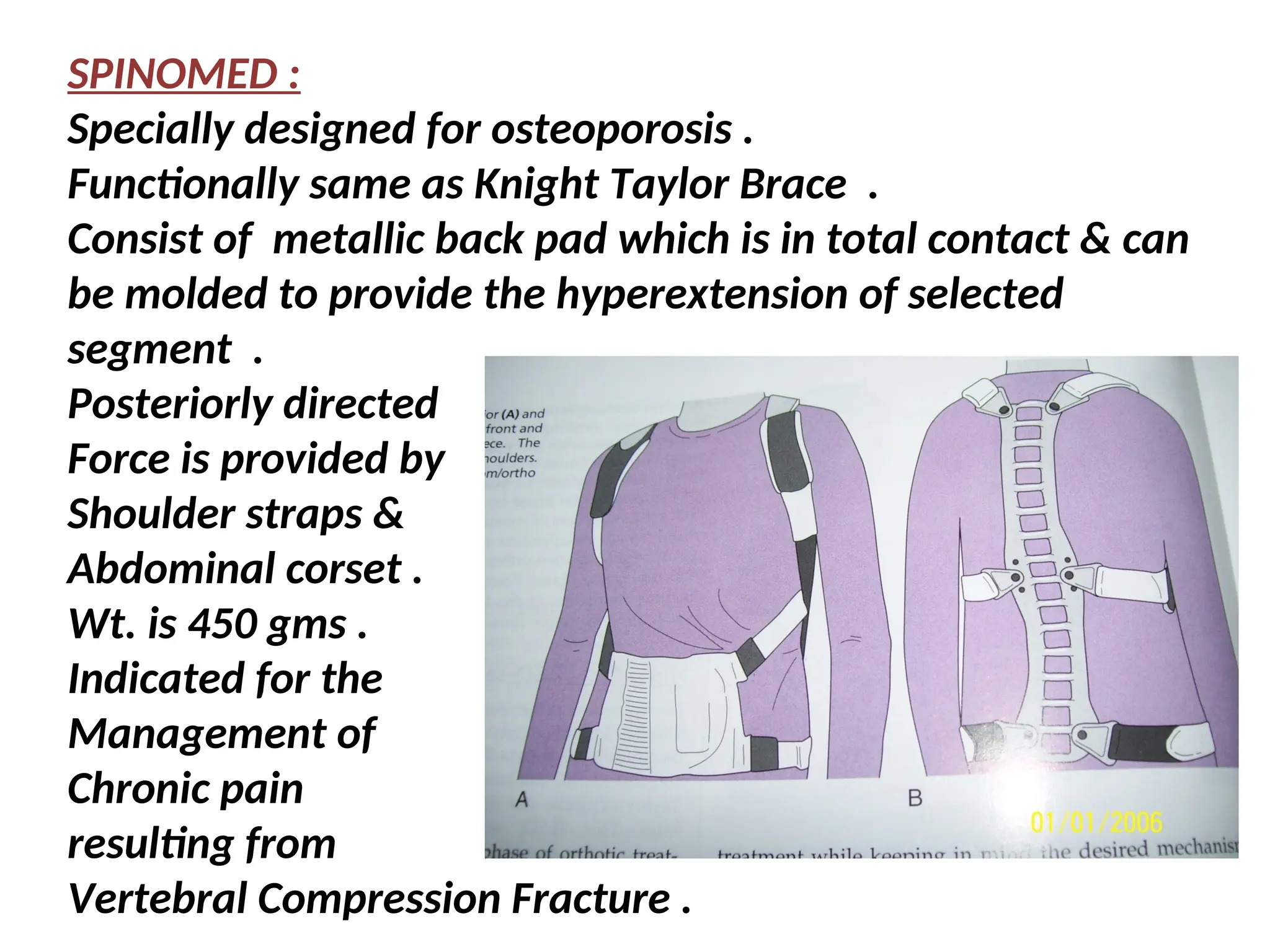 SPINOMED :
Specially designed for osteoporosis .
Functionally same as Knight Taylor Brace .
Consist of metallic back pad which is in total contact & can
be molded to provide the hyperextension of selected
segment .
Posteriorly directed
Force is provided by
Shoulder straps &
Abdominal corset .
Wt. is 450 gms .
Indicated for the
Management of
Chronic pain
resulting from
Vertebral Compression Fracture .
 