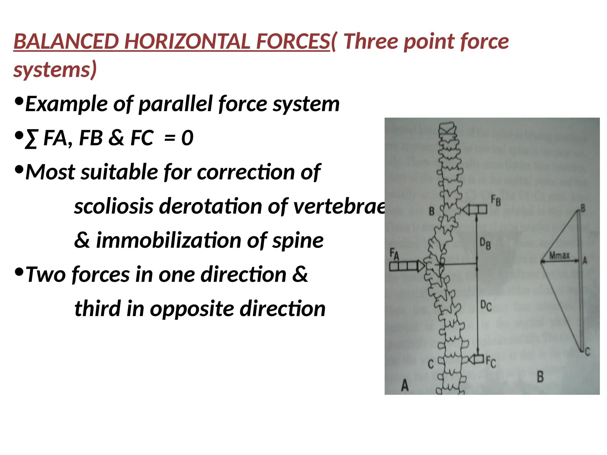 BALANCED HORIZONTAL FORCES( Three point force
systems)
•Example of parallel force system
•∑ FA, FB & FC = 0
•Most suitable for correction of
scoliosis derotation of vertebrae
& immobilization of spine
•Two forces in one direction &
third in opposite direction
 