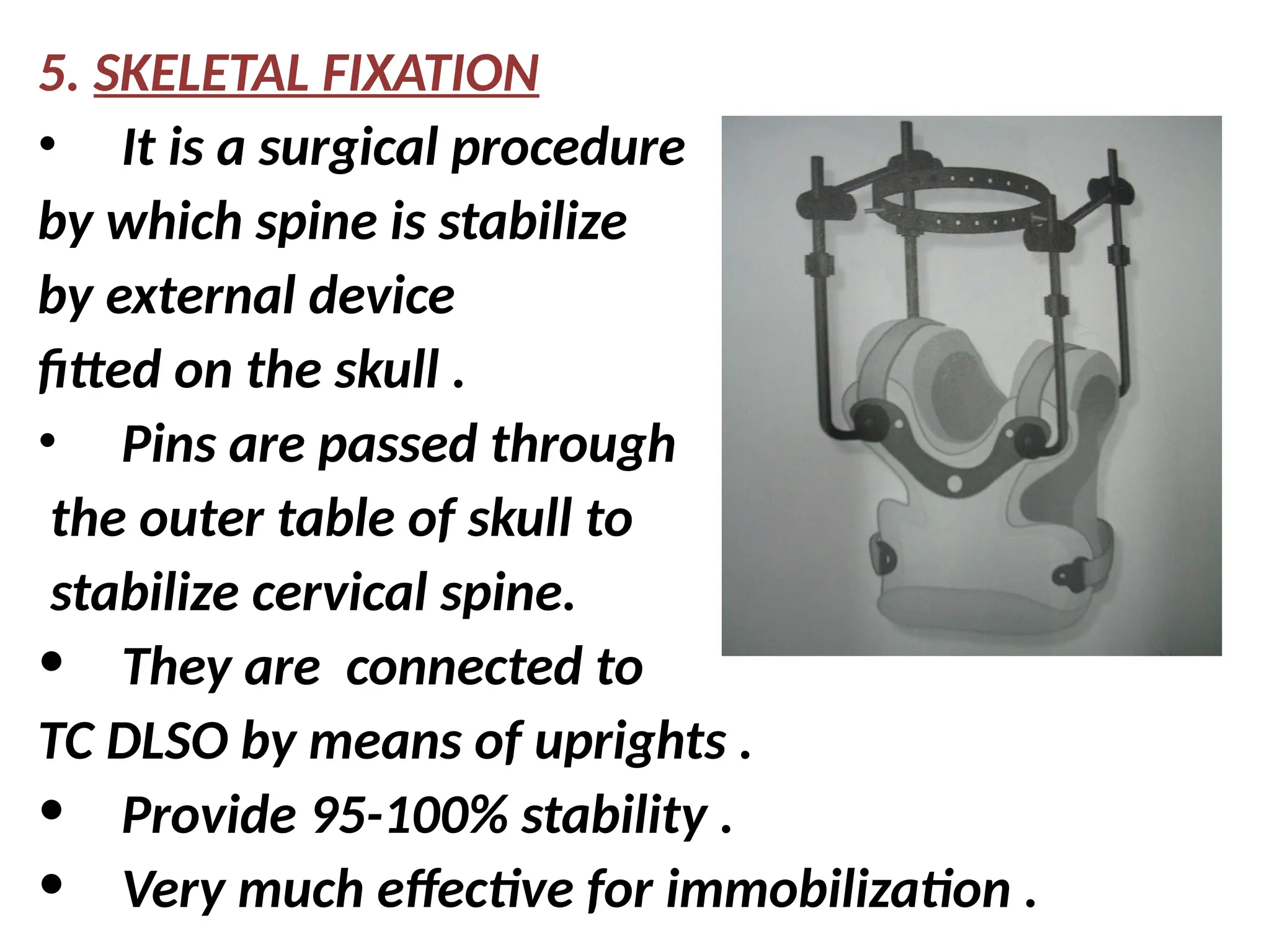 5. SKELETAL FIXATION
• It is a surgical procedure
by which spine is stabilize
by external device
fitted on the skull .
• Pins are passed through
the outer table of skull to
stabilize cervical spine.
• They are connected to
TC DLSO by means of uprights .
• Provide 95-100% stability .
• Very much effective for immobilization .
 