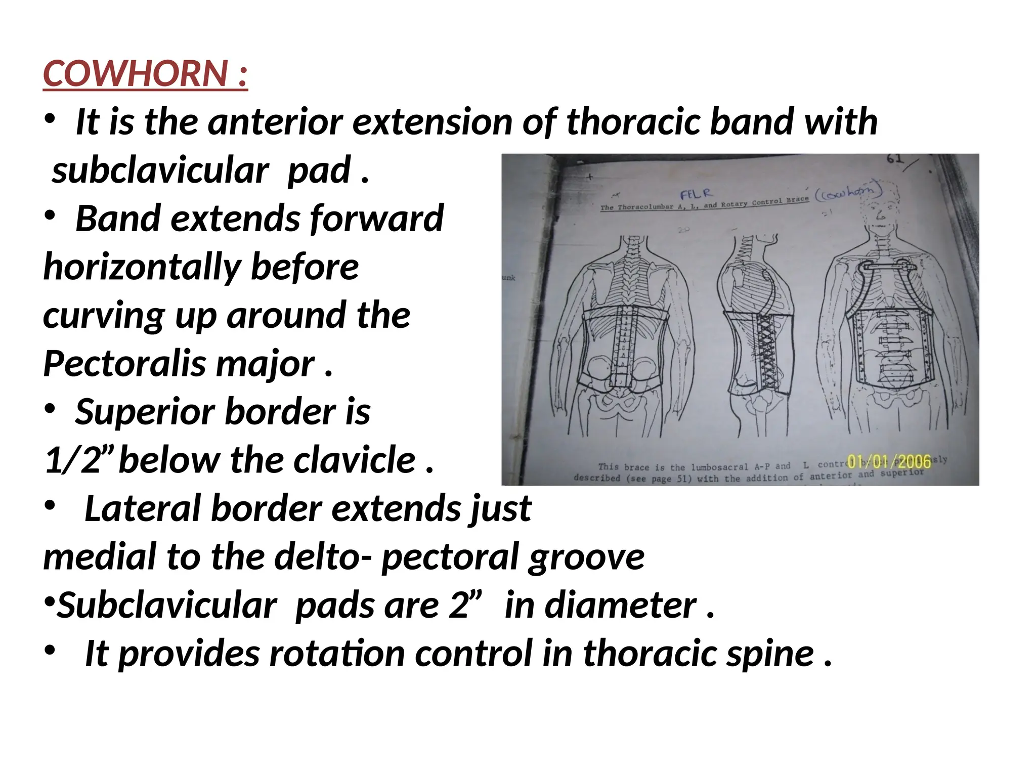 COWHORN :
• It is the anterior extension of thoracic band with
subclavicular pad .
• Band extends forward
horizontally before
curving up around the
Pectoralis major .
• Superior border is
1/2”below the clavicle .
• Lateral border extends just
medial to the delto- pectoral groove
•Subclavicular pads are 2” in diameter .
• It provides rotation control in thoracic spine .
 
